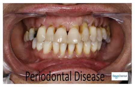 Can Periodontal Disease Kill My Dog