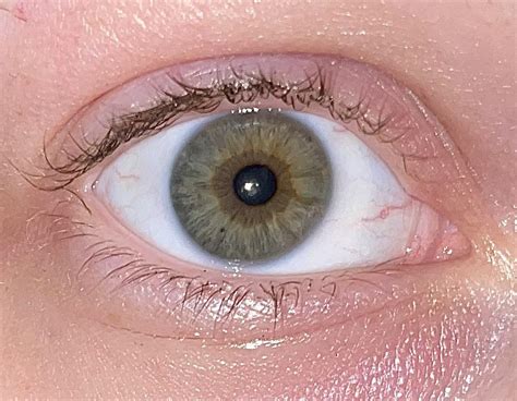 Is this considered Central Heterochromia? : r/eyes