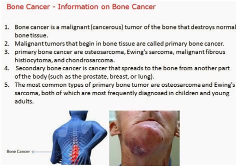 Cancer Symptoms: Cancer Symptoms In Adults