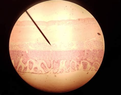 duodenum microscope quiz