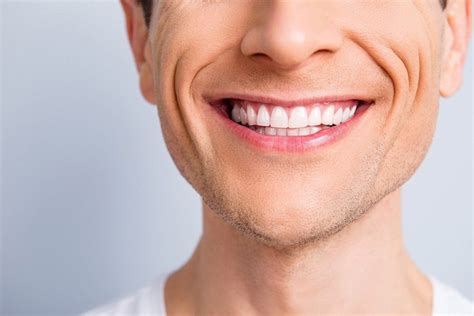 5 Things to Know About Teeth Shifting