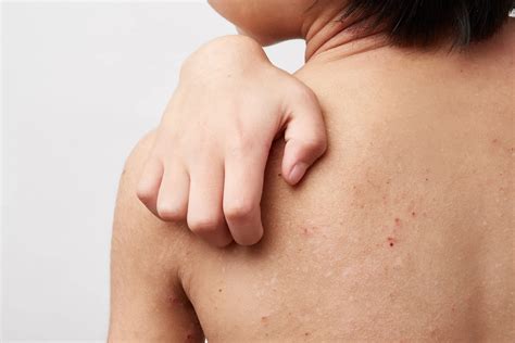 Dermatology Services – Advanced Skin Care Solutions By Dr. Harrison P