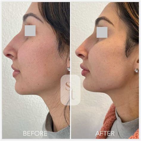 Skin Theory – Anti-aging and Laser Center