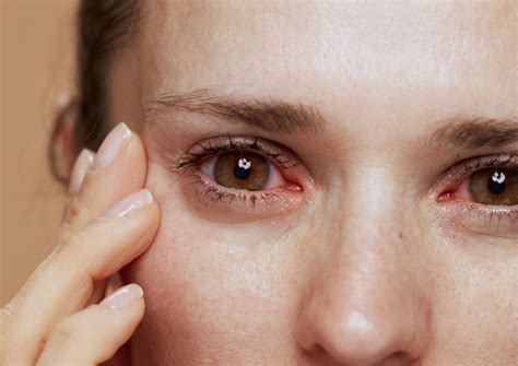 Eye Pain: Causes, Common Conditions, and Treatment