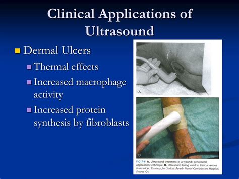 PPT - Ultrasound PowerPoint Presentation, free download - ID:1873680