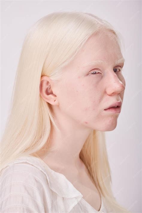 Premium Photo | Albino woman with unusual appearance