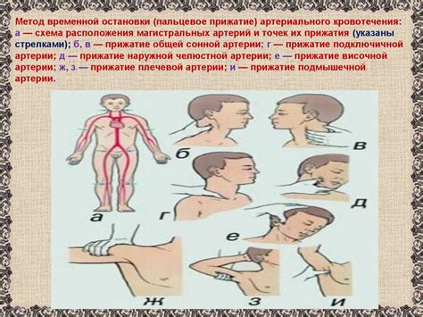 Первая помощь при кровотечении - online presentation