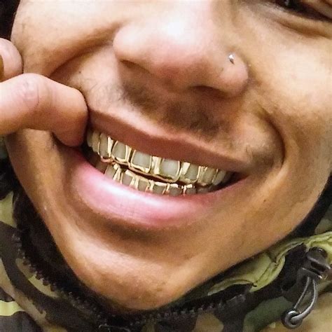 Open Face Gold Teeth