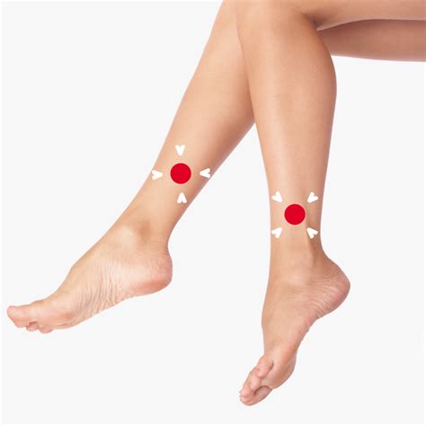 Trophic Ulcer Treatment in Ukraine
