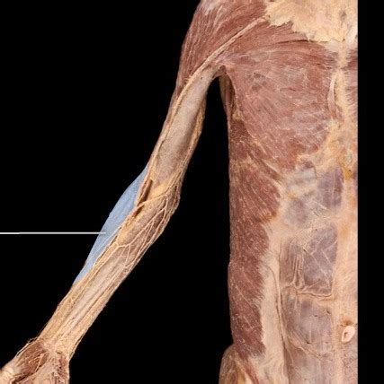 brachioradialis cadaver
