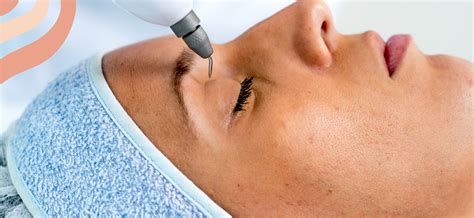 Jato de Plasma para Rejuvenescimento: Como Funciona e Quais Resultados