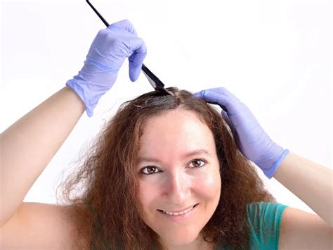 The Unforgiving Stain Of Hair Dye: 5 Ways To Rescue Your Skin