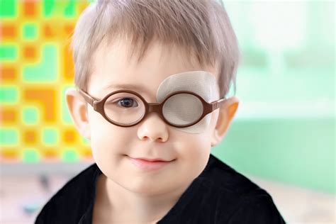 Strabismus | Pretoria Eye Institute