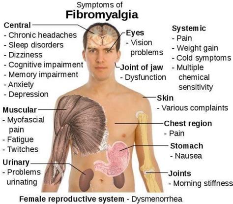 Symptoms of Fibro | Fibromyalgia causes, Fibromyalgia symptoms ...