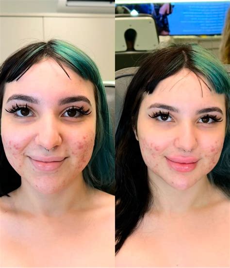 Belle Belinha Dando O Cu - Influenciadora Belle Belinha faz harmonização facial; veja antes e depois