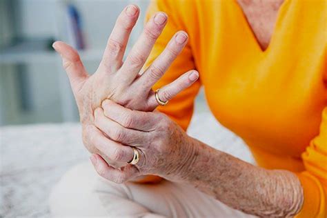 Arthritis of the hand - Hand Surgery – Hand Specialist | Montreal ...