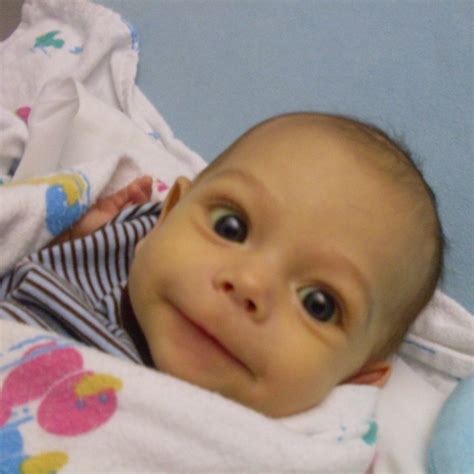 Rare Genetic Disorders In Children 