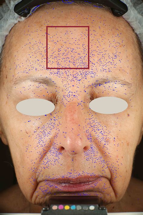 The Skin Biotic | AWvi