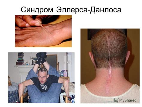 Презентация на тему: "Лекция Генотип как система взаимодействующих ...