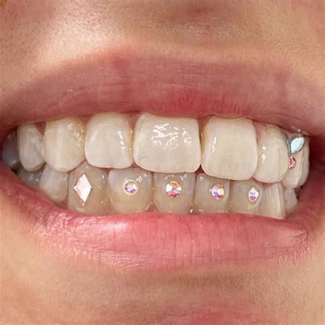 how to get tooth gems off