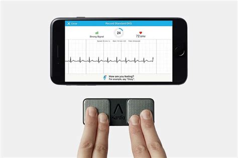 Kardia Mobile EKG | GearMoose