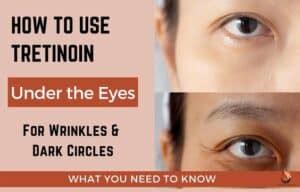 Tretinoin For Under Eye Circles & Wrinkles: What to Know - Sasily Skin