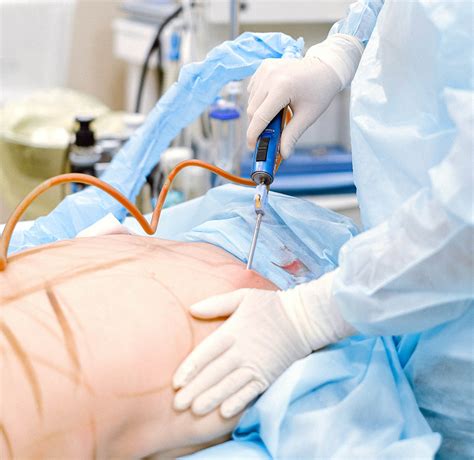 liposuction     cost   worth  foxenycom