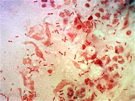 Haemophilus Gram Stain