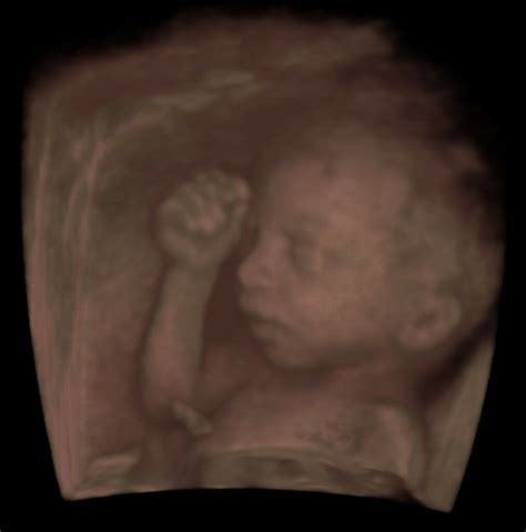 cinematic volume rendering   web browser volview  vtkjs