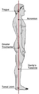 Pain-Free Physiotherapy: Posture Analysis with Dr. Jha