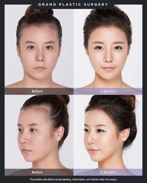 big forehead beauty hacks  tips tricks    forehead