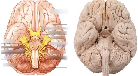 Cranial Nerve (from Nerve plexuses, nerve branches & skeletal muscle ...