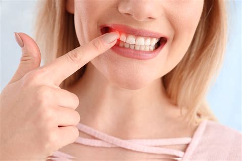 how to stop bleeding on gums 13