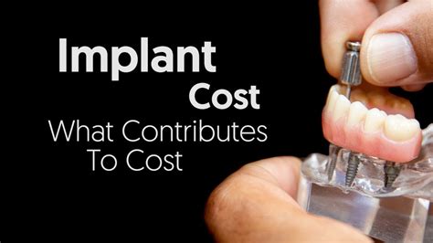 investing  implants  determines cost youtube