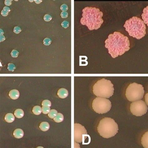 evaluation    chromogenic medium candida id