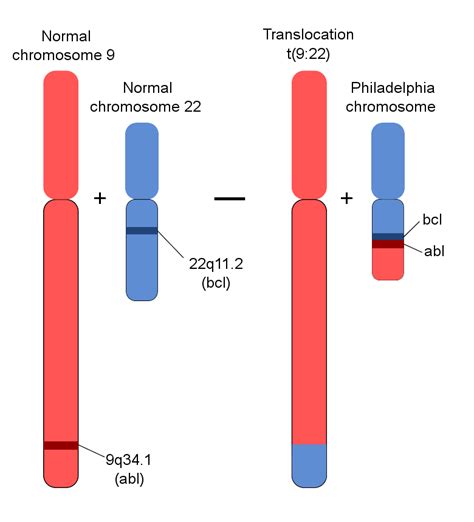 Translocation, Genetic; Chromosomal Translocation; Translocation, Chromosomal