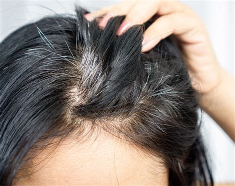 how to stop greying hair