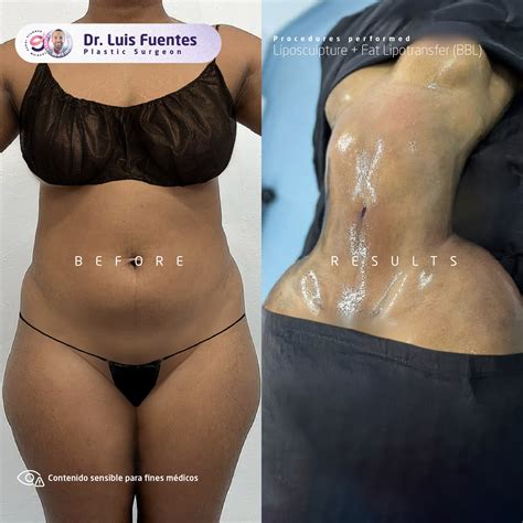 Dr. Luis Fuentes' Planner | Plastic Surgery (@drluisfuentesplanner