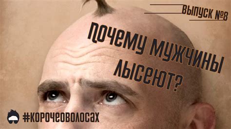 Почему мужчины лысеют? Андрогенетический, мужской тип облысения ...