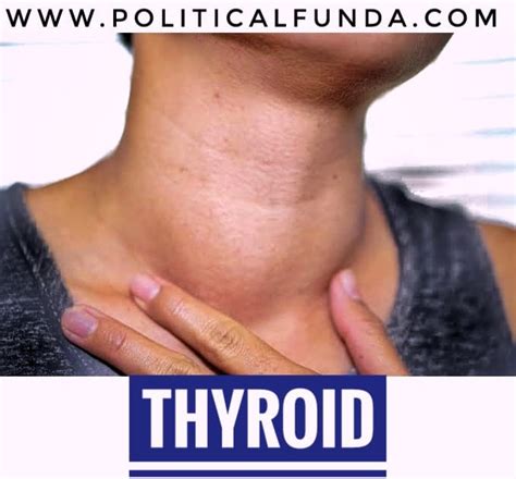 Thyroid | Thyroid: Causes, Types, Symptoms & Home Remedies