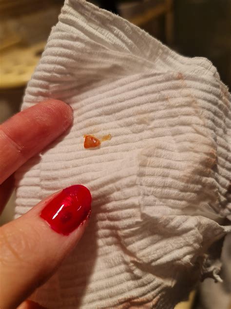 Weird clots after being Pregnant : r/Periods