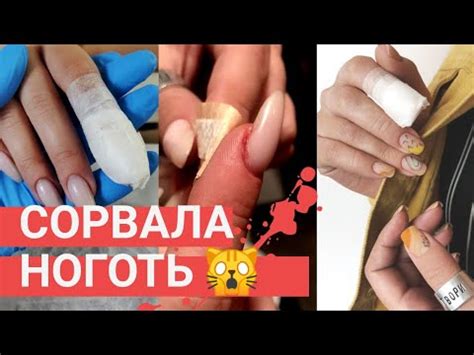СРОЧНО спасаю ноготь 😰 СОРВАННЫЙ ноготь — что делать? Модный маникюр ...