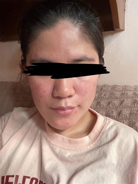 [routine help] Is too many active ingredients bad for my skin? : r