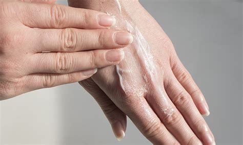 klogs ultimate guide     rid  cracked hands