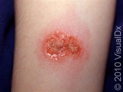 impetuous  rash