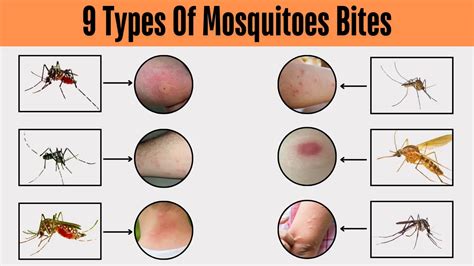 danger signs   worry   mosquito bite