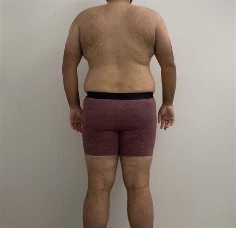 My urologist is going to lose his mind when he sees my blood draw for