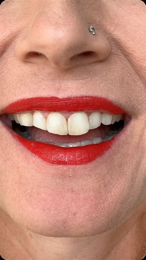 Lia Ann Kovach | Can you kiss me back? | Instagram