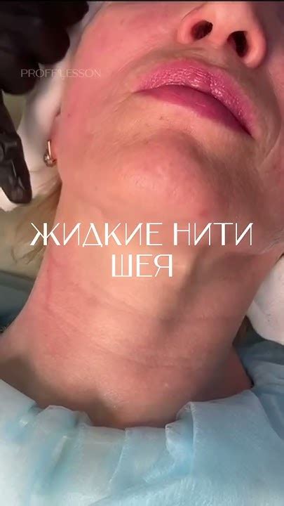 Жидкие нити. Запись на все обучающие программы ️ inst:dr.antonina_guz ...