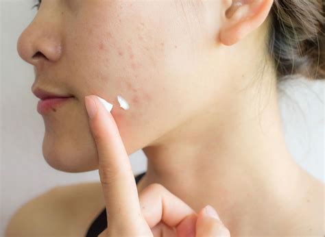 Can Makeup Cause Breakouts? Not If You’re Using the Right One ...